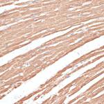 KIF4A Antibody in Immunohistochemistry (Paraffin) (IHC (P))