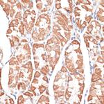 KIF4A Antibody in Immunohistochemistry (Paraffin) (IHC (P))