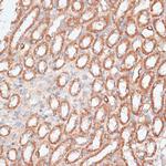 KIF4A Antibody in Immunohistochemistry (Paraffin) (IHC (P))