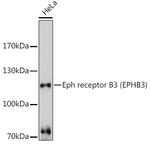 EphB3 Antibody in Western Blot (WB)