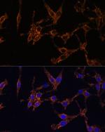 14-3-3 beta Antibody in Immunocytochemistry (ICC/IF)