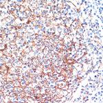 14-3-3 beta Antibody in Immunohistochemistry (Paraffin) (IHC (P))