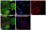 Cytokeratin 8 Antibody in Immunocytochemistry (ICC/IF)