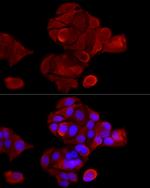 Cytokeratin 8 Antibody in Immunocytochemistry (ICC/IF)