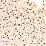 NR2F2 Antibody in Immunohistochemistry (Paraffin) (IHC (P))