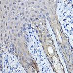 14-3-3 sigma Antibody in Immunohistochemistry (Paraffin) (IHC (P))