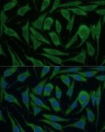 KIF14 Antibody in Immunocytochemistry (ICC/IF)