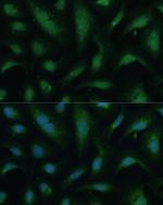 KIF14 Antibody in Immunocytochemistry (ICC/IF)