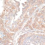 KIF14 Antibody in Immunohistochemistry (Paraffin) (IHC (P))