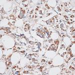 KIF14 Antibody in Immunohistochemistry (Paraffin) (IHC (P))