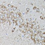 SNAPAP Antibody in Immunohistochemistry (Paraffin) (IHC (P))