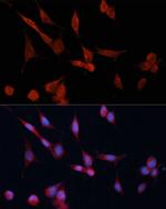 DDAH1 Antibody in Immunocytochemistry (ICC/IF)