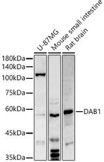 DAB1 Antibody in Western Blot (WB)