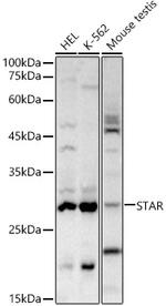 STAR Antibody in Western Blot (WB)