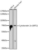 Cytokeratin 2e Antibody in Western Blot (WB)