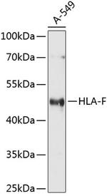 HLA-F Antibody in Western Blot (WB)