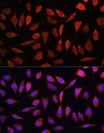 SLC39A8 Antibody in Immunocytochemistry (ICC/IF)