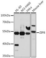 SLC39A8 Antibody in Western Blot (WB)