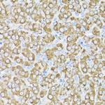 THUMPD3 Antibody in Immunohistochemistry (Paraffin) (IHC (P))