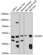 AP3M1 Antibody in Western Blot (WB)