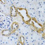 SLC4A5 Antibody in Immunohistochemistry (Paraffin) (IHC (P))