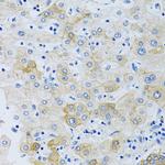 SLC4A5 Antibody in Immunohistochemistry (Paraffin) (IHC (P))