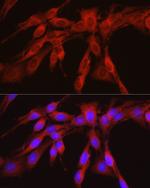 PHGDH Antibody in Immunocytochemistry (ICC/IF)