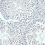 GAPDHS Antibody in Immunohistochemistry (Paraffin) (IHC (P))