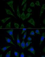 AKR1C2 Antibody in Immunocytochemistry (ICC/IF)