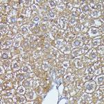 AKR1C2 Antibody in Immunohistochemistry (Paraffin) (IHC (P))