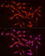 TREM2 Antibody in Immunocytochemistry (ICC/IF)