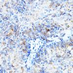 MULT1 (NKG2D Ligand) Antibody in Immunohistochemistry (Paraffin) (IHC (P))