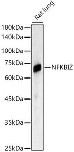 IkB zeta Antibody in Western Blot (WB)