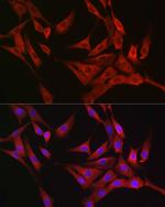 RASGRP1 Antibody in Immunocytochemistry (ICC/IF)