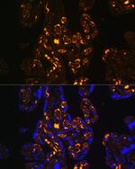 LRP8 Antibody in Immunohistochemistry (Paraffin) (IHC (P))