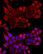 VDAC3 Antibody in Immunocytochemistry (ICC/IF)