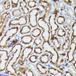 VDAC3 Antibody in Immunohistochemistry (Paraffin) (IHC (P))