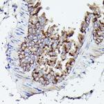 VDAC3 Antibody in Immunohistochemistry (Paraffin) (IHC (P))