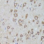 LGR5 Antibody in Immunohistochemistry (Paraffin) (IHC (P))