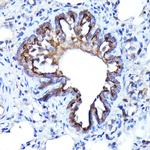 LGR5 Antibody in Immunohistochemistry (Paraffin) (IHC (P))