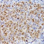 LGR5 Antibody in Immunohistochemistry (Paraffin) (IHC (P))