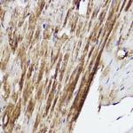 PLOD3 Antibody in Immunohistochemistry (Paraffin) (IHC (P))