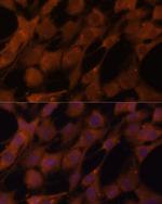 LGMN Antibody in Immunocytochemistry (ICC/IF)