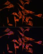 LGMN Antibody in Immunocytochemistry (ICC/IF)