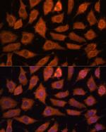 LGMN Antibody in Immunocytochemistry (ICC/IF)