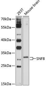 EAP30 Antibody in Western Blot (WB)