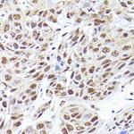 SEC14L2 Antibody in Immunohistochemistry (Paraffin) (IHC (P))