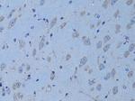 HADH Antibody in Immunohistochemistry (Paraffin) (IHC (P))