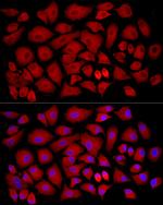 SLC27A2 Antibody in Immunocytochemistry (ICC/IF)