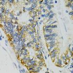 SLC27A2 Antibody in Immunohistochemistry (Paraffin) (IHC (P))